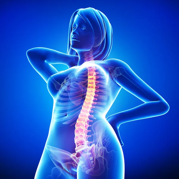 Dolor de columna vertebral femenina — Foto de Stock