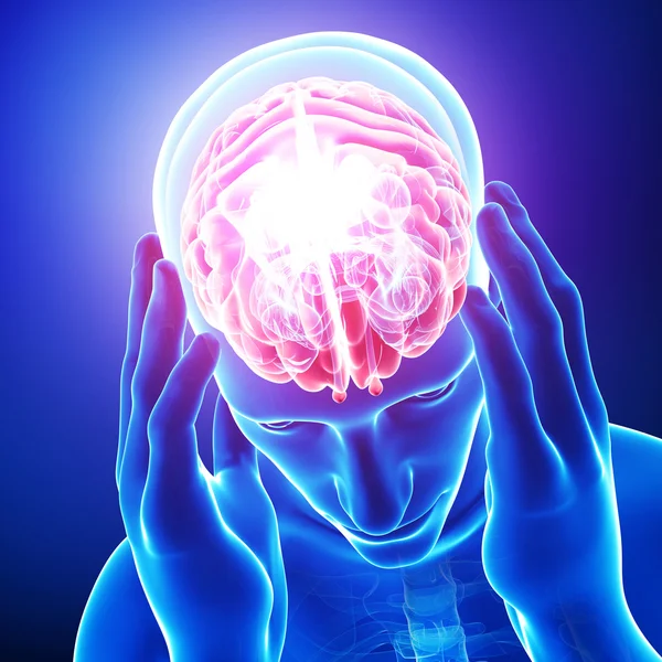 Anatomia da dor cerebral — Fotografia de Stock