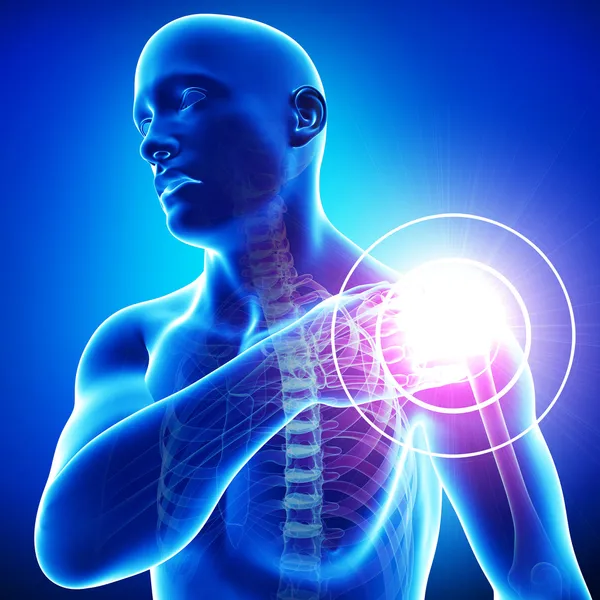 Shoulder pain — Stock Photo, Image