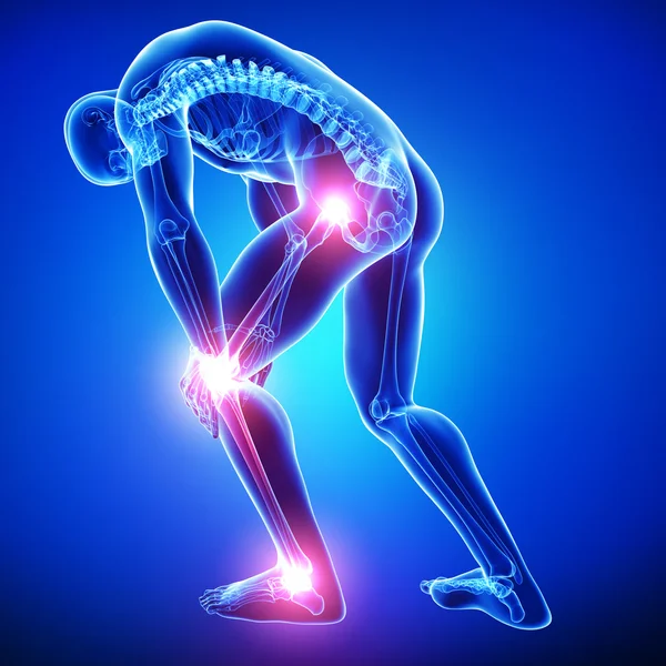 Male knee pain — Stock Photo, Image