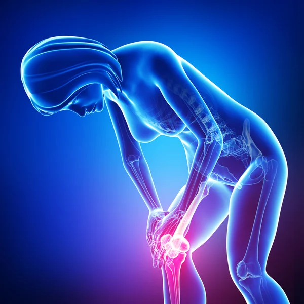 女性膝关节疼痛 — 图库照片