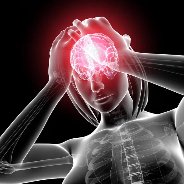 Dolore cerebrale femminile — Foto Stock