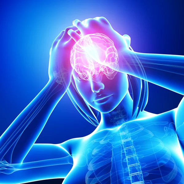 Vrouwelijke hersenen pijn — Stockfoto