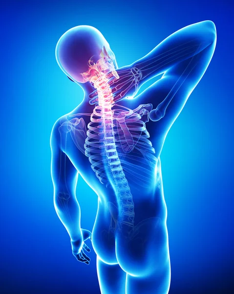 X-ray of neck pain — Stock Photo, Image