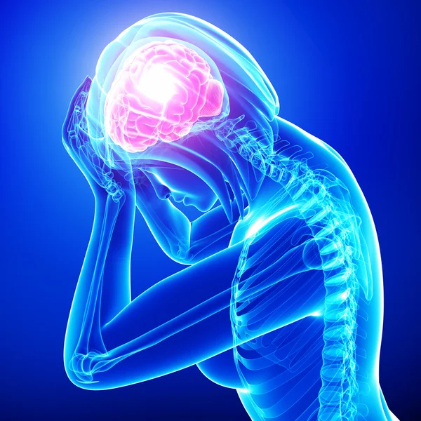 Female brain pain — Stock Photo, Image