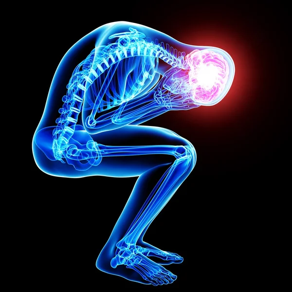 Beyin ağrısı anatomisi