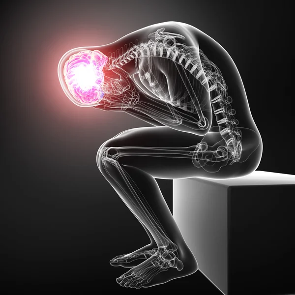 Beyin ağrısı anatomisi