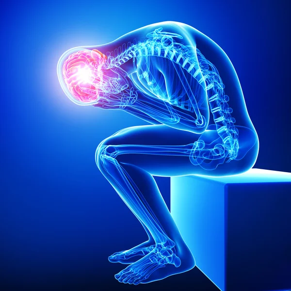 Brain pain anatomy — Stock Photo, Image