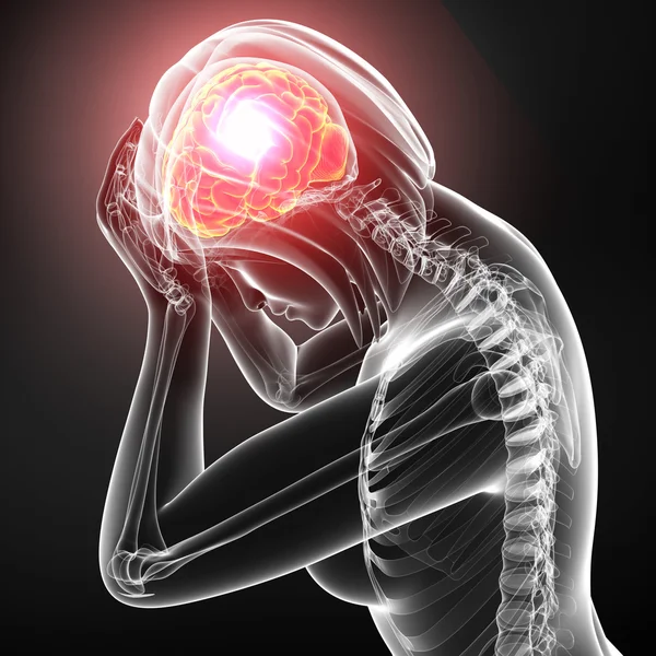 Vrouwelijke hersenen pijn — Stockfoto