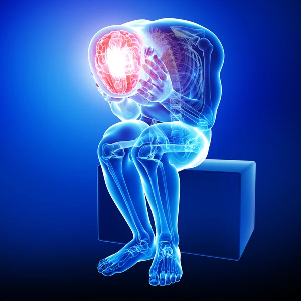 Anatomia da dor cerebral — Fotografia de Stock