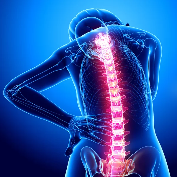 Female spine pain — Stock Photo, Image