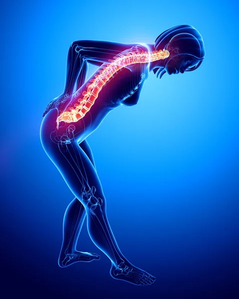 Female back pain — Stock Photo, Image