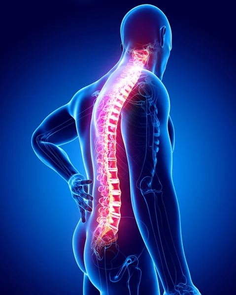 Dolor de columna vertebral masculino — Foto de Stock