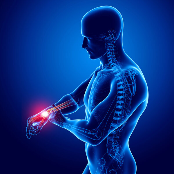 Анатомия боли в руках в синем
