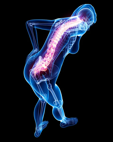 女性の背中の痛み — ストック写真