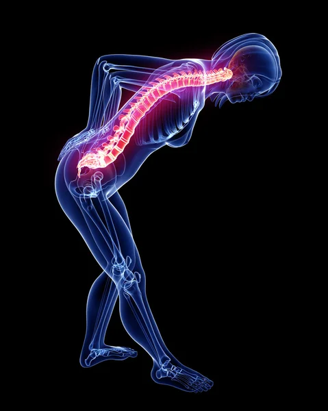 Dolor de espalda femenino —  Fotos de Stock