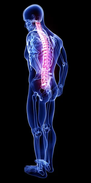 Anatomie von Rückenschmerzen — Stockfoto