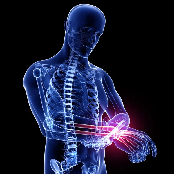 el ağrısı anatomisi