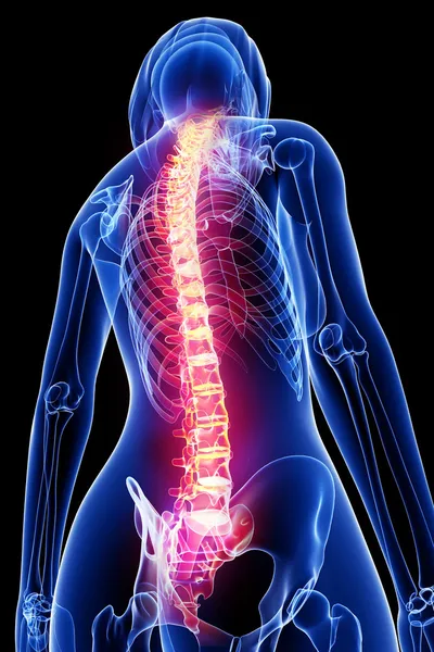 Female spine pain x-ray anatomy — Stock Photo, Image