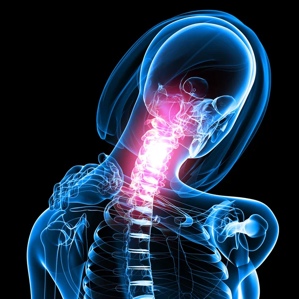 Anatomi kadın omurga ağrısı — Stok fotoğraf