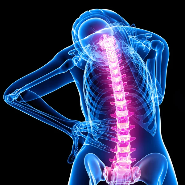 Female spine pain x-ray anatomy — Stock Photo, Image