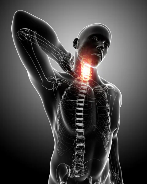 X-ray of spine pain — Stock Photo, Image