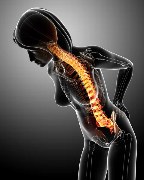 Female back pain — Stock Photo, Image