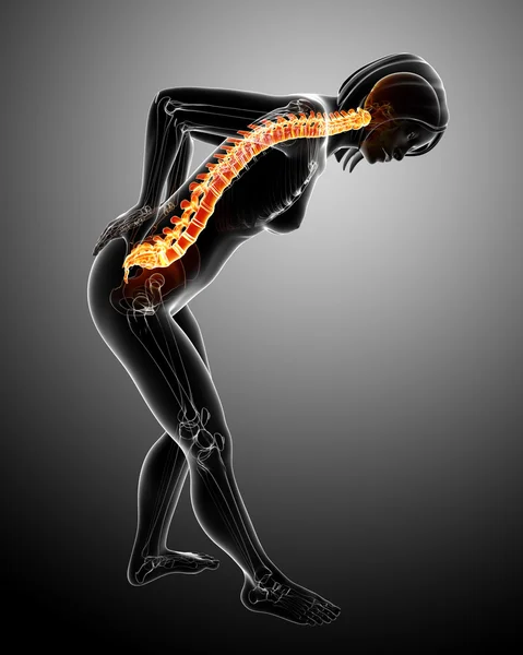 Rückenschmerzen bei Frauen — Stockfoto