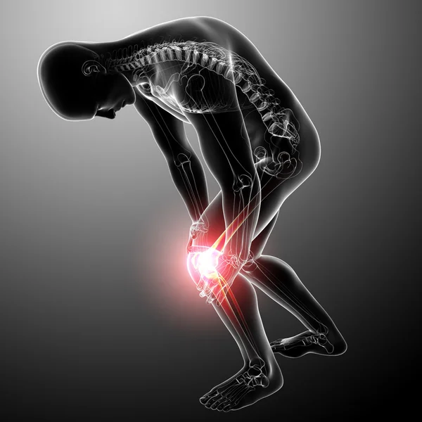 Πόνο στο γόνατο αρσενικό — Φωτογραφία Αρχείου