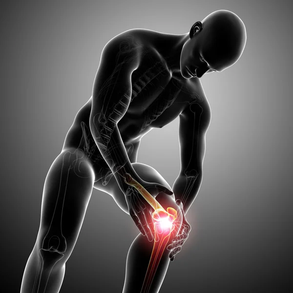 Dolore al ginocchio maschile — Foto Stock