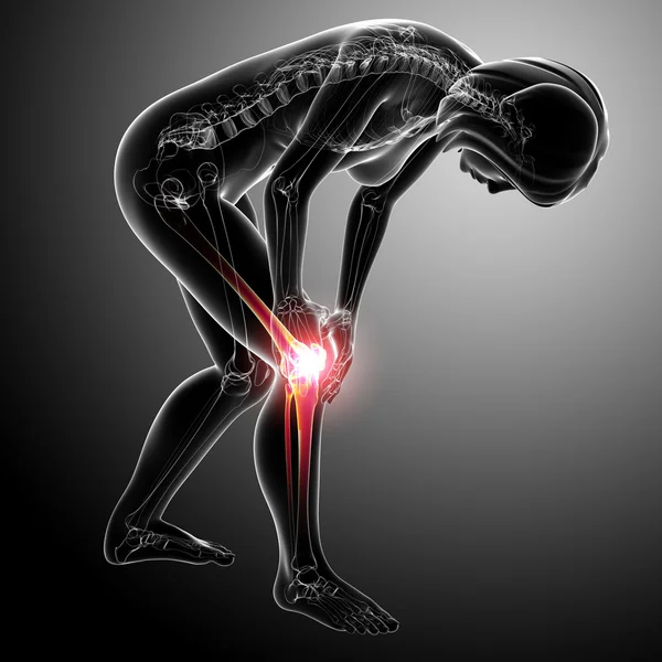Πόνο στο γόνατο θηλυκό — Φωτογραφία Αρχείου