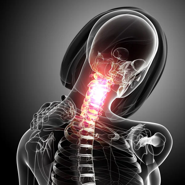 Анатомія жіночого хребта біль — стокове фото