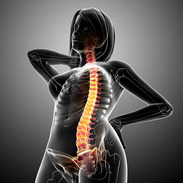 Dolor de columna vertebral femenina —  Fotos de Stock