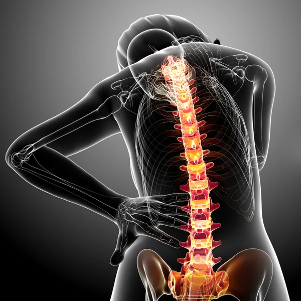 Dolor de columna vertebral femenina — Foto de Stock