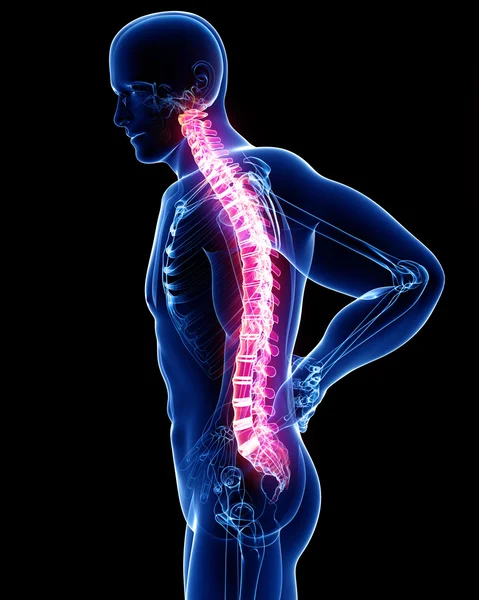 背中の痛みの解剖学 — ストック写真