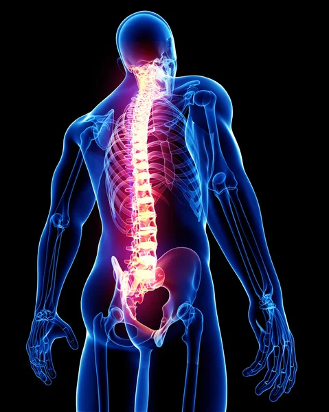 背中の痛みの解剖学 — ストック写真
