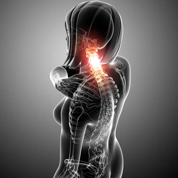 Nyak fájdalom női röntgen Jogdíjmentes Stock Fotók