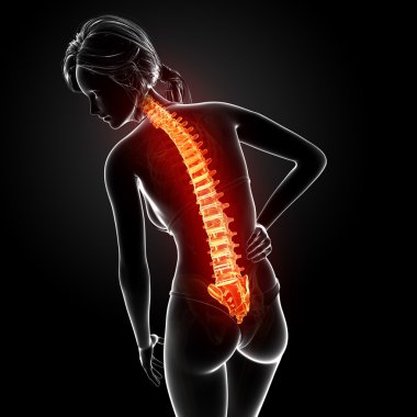 illüstrasyon insan sırt ağrısı vurgulanan spinal kord ile