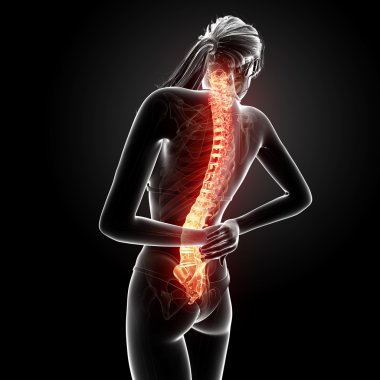 illüstrasyon insan sırt ağrısı vurgulanan spinal kord ile