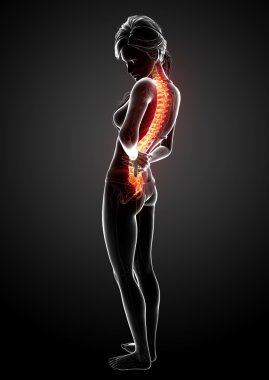 illüstrasyon insan sırt ağrısı vurgulanan spinal kord ile