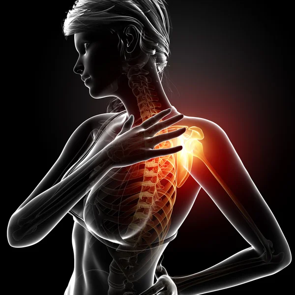 Ilustración del hombro resaltado dolor en el hombro — Foto de Stock