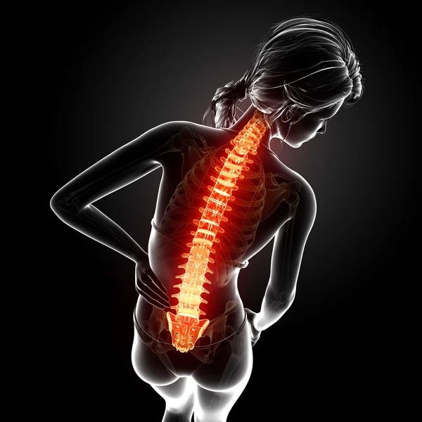 Ilustracja ludzki ból pleców z podświetloną rdzenia kręgowego — Zdjęcie stockowe