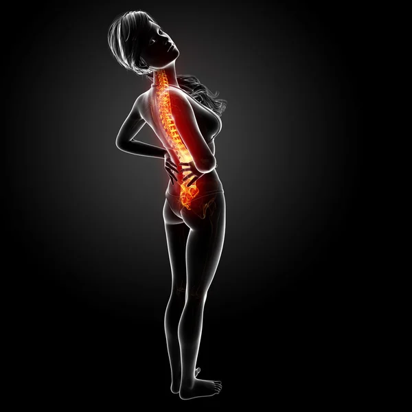 강조 표시 된 척수와 인간의 허리 통증의 그림 — 스톡 사진