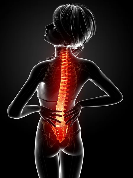 Illustration of human back pain with highlighted spinal cord — Stock Photo, Image