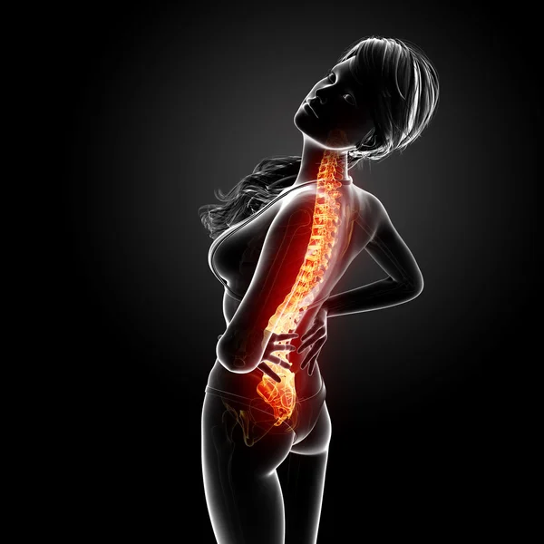 突出显示脊髓人类腰痛的插图 — 图库照片