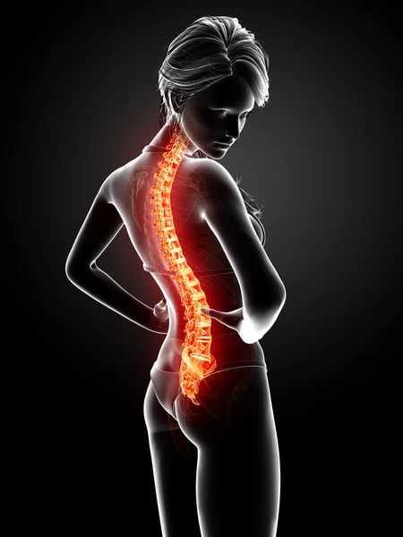 Ілюстрація болю в спині людини з підсвіченим спинним мозком — стокове фото