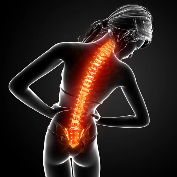 Иллюстрация боли в спине с выделенным спинным мозгом — стоковое фото