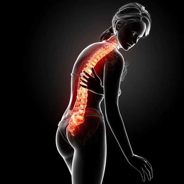 Illustration of human back pain with highlighted spinal cord — Stock Photo, Image