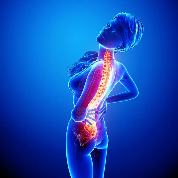 Illustration of human spine pain with highlighted spinal cord in blue — Stock Photo, Image