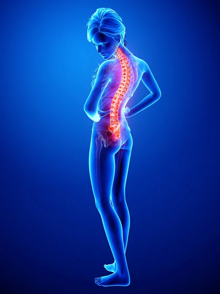 用蓝色突出显示脊髓损伤人体脊柱疼痛的插图 — 图库照片